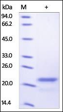Human Sonic Hedgehog Protein, His Tag