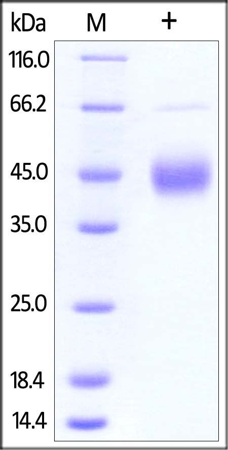 Human TFPI Protein, His Tag