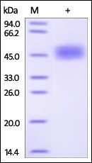 Human uPAR Protein, His Tag