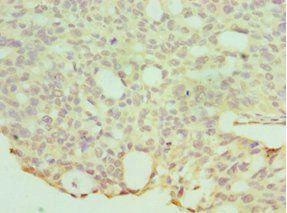 HYAL1 Antibody