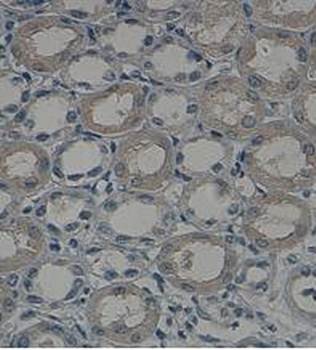 HYAL1 Rabbit Polyclonal Antibody