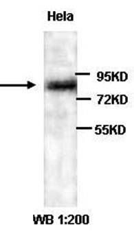 HYAL1 Rabbit Polyclonal Antibody