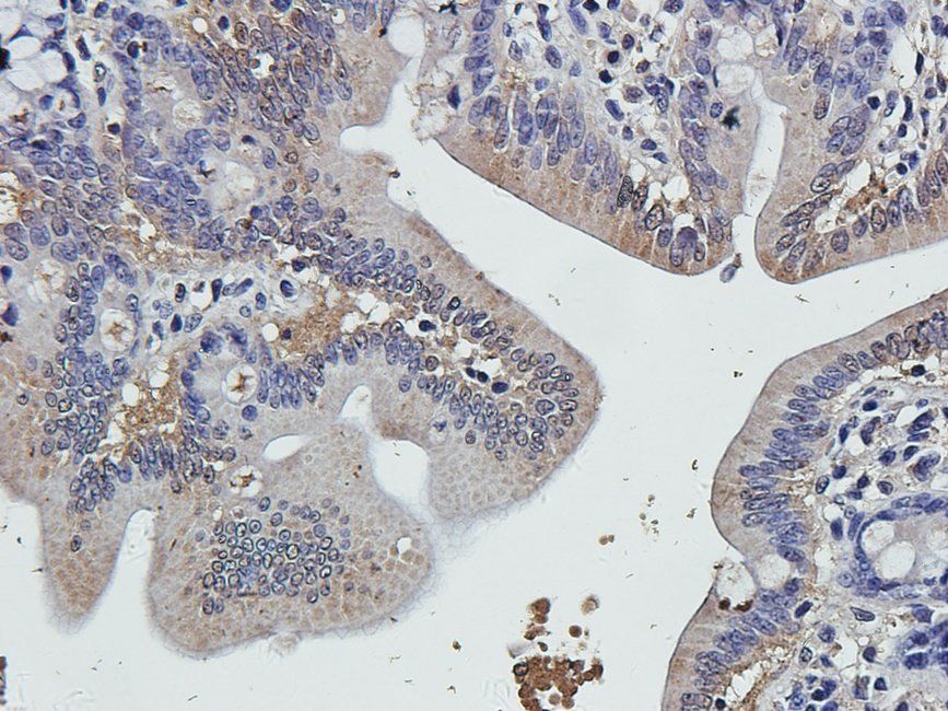 HYAS2 Rabbit Polyclonal Antibody