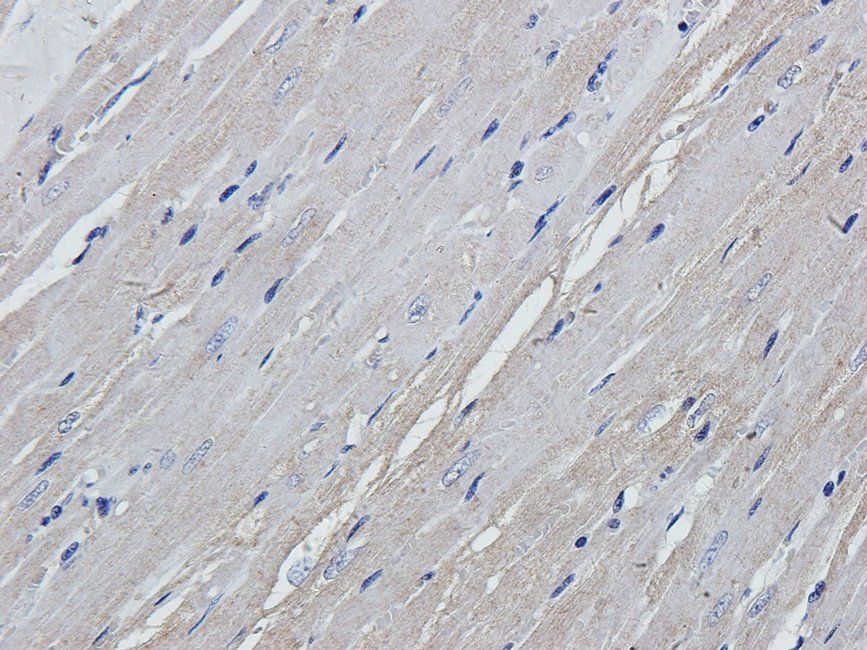 HYAS2 Rabbit Polyclonal Antibody