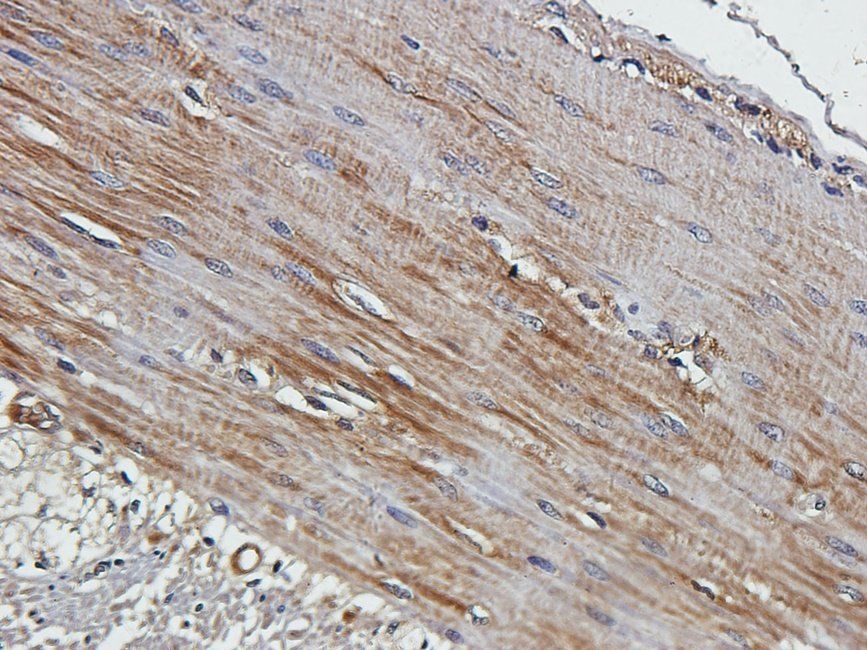 HYAS2 Rabbit Polyclonal Antibody