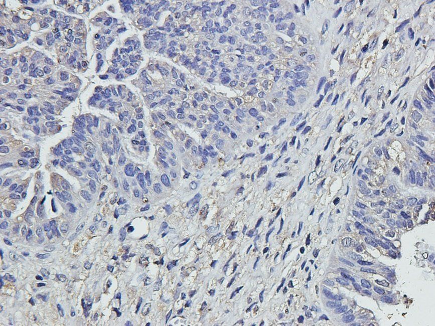 HYAS2 Rabbit Polyclonal Antibody