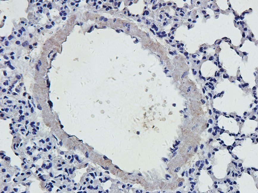 HYAS2 Rabbit Polyclonal Antibody