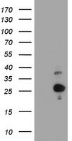 Hydroxysteroid (17 beta) Dehydrogenase 4 Antibody