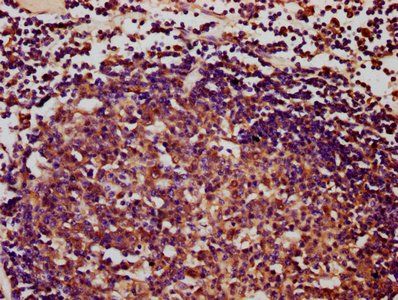 IBA57 Antibody