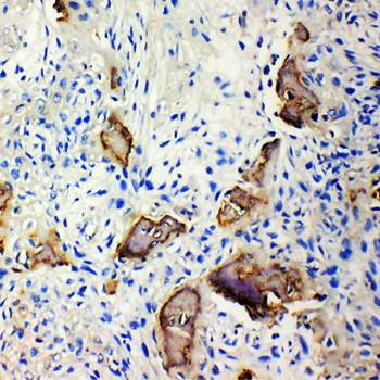 Bone Sialoprotein/IBSP Rabbit Polyclonal Antibody