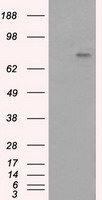 DFFA Antibody