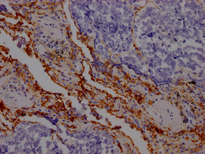 ICAM1 Antibody