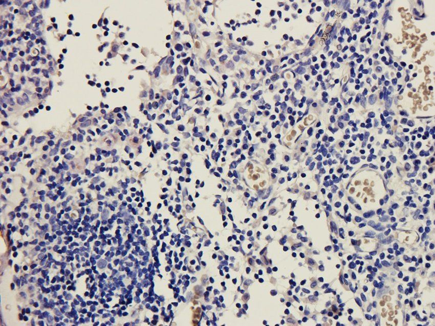ICAM1 Mouse Monoclonal Antibody