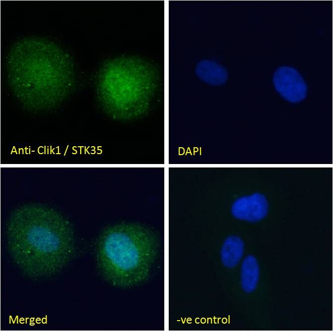 Clik1/STK35 Antibody