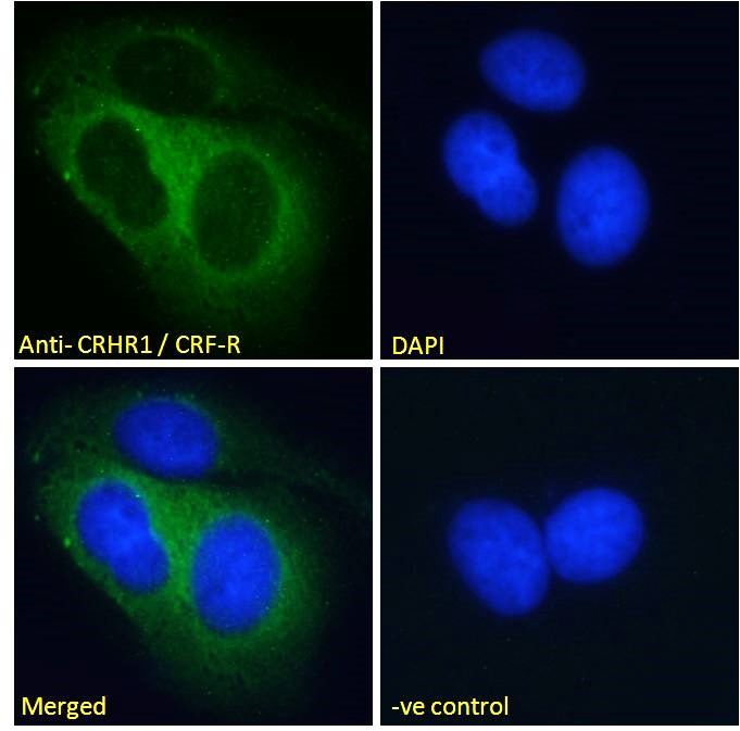 CRHR1/CRF-R (aa 250 - 263) Antibody