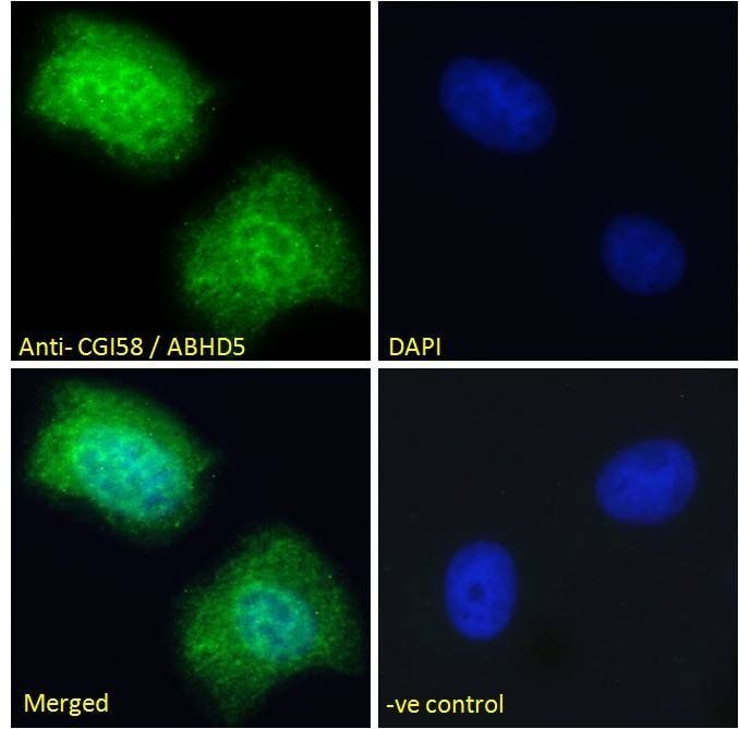 CGI58/ABHD5 Antibody