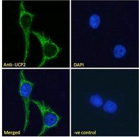 Uncoupling protein 2/UCP2 Antibody