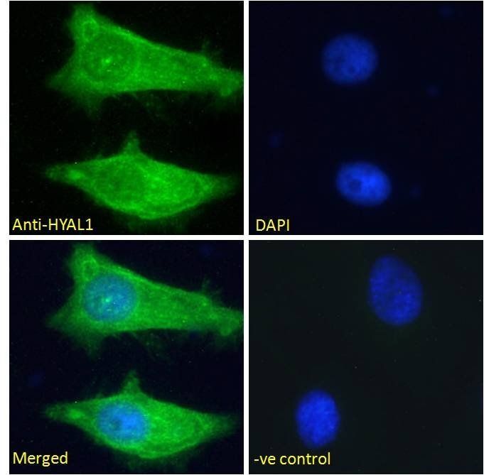 Hyaluronidase 1 Antibody