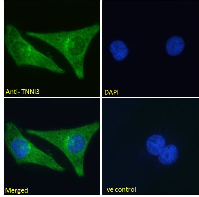 TNNI3 (aa117-127) Antibody
