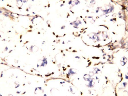 IFITM1 Rabbit Polyclonal Antibody