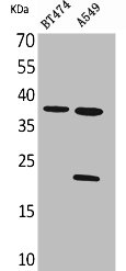 IFNA1 Antibody
