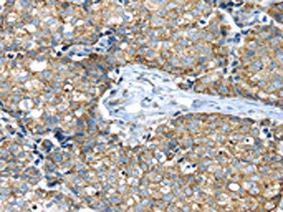 IFNA2 Antibody