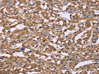 IFNA2 Antibody
