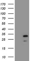 IFNGR2 Antibody