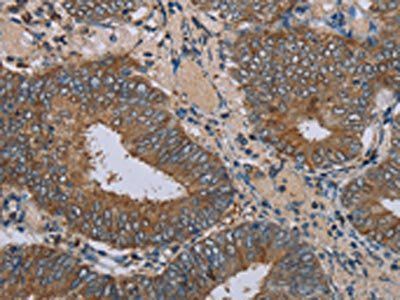 IFRD1 Antibody