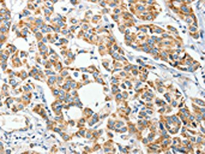 IFT74 Antibody