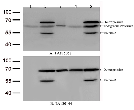 IGF2BP1 Antibody