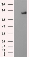 IGF2BP1 Antibody