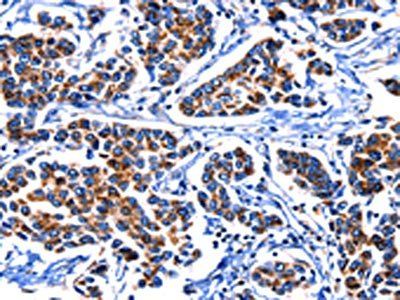 IGF2BP2 Antibody