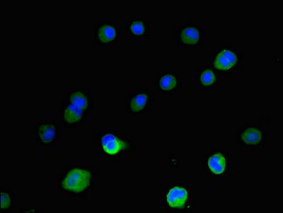 IGF2BP3 Antibody