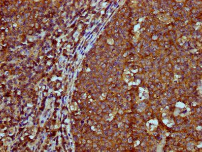 IGHM Antibody