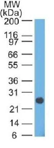 IGLV1-51 Antibody