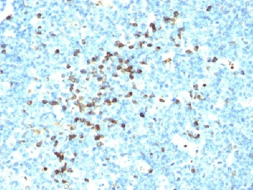 IGLV1-51 Antibody