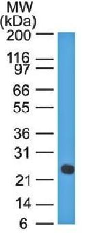 IGLV1-51 Antibody
