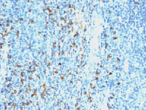 IGLV1-51 Antibody