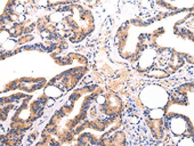 IGLV1-51 Antibody