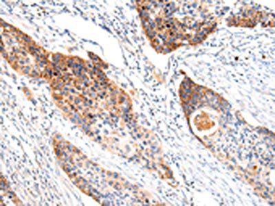 IGLV1-51 Antibody