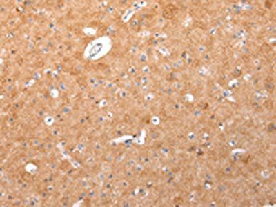 IGLV1-51 Antibody