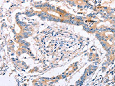IGSF8 Antibody