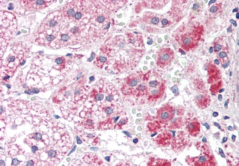 ALDH3A2 Antibody
