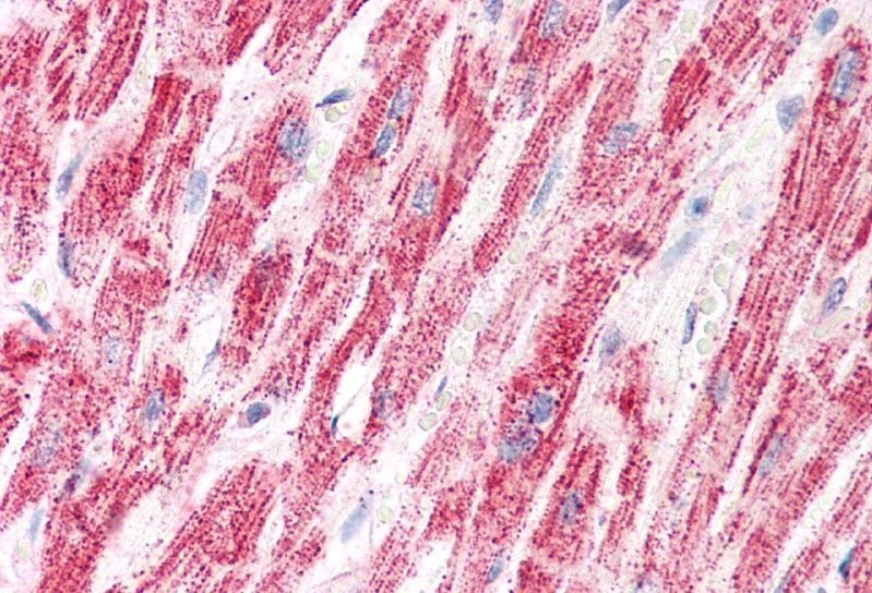 ETFA (aa139-152) Antibody