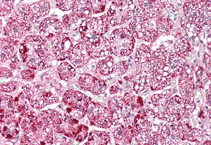 ETFA (aa139-152) Antibody