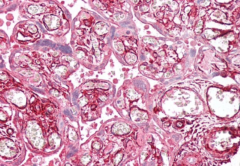 tropomyosin 4/TPM4 Antibody