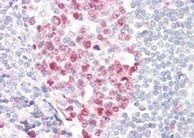 dUTPase/DUT Antibody