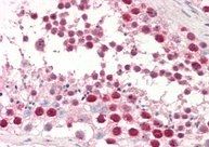 dUTPase/DUT Antibody