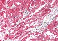 Ketohexokinase Antibody